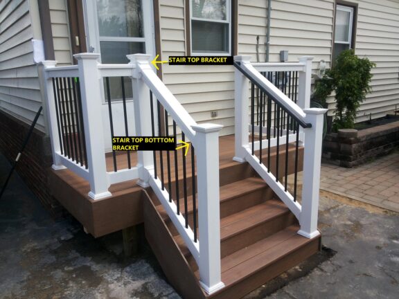 Stair T Bottom Rail Bracket Kit - Image 3